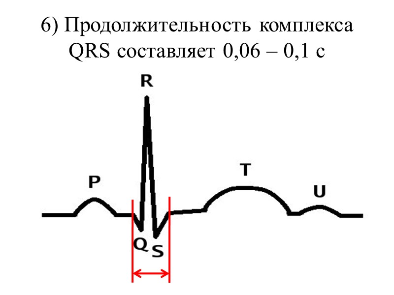 6) Продолжительность комплекса QRS составляет 0,06 – 0,1 с